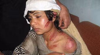 Nan giải nạn bạo hành phụ nữ 