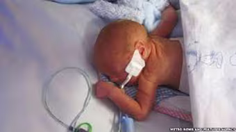 Sự sống 36 ngày