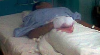 Bị đâm chết sau khi ăn thịt chó