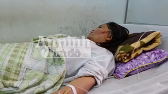 Bố chồng ẩu đả, chém biến dạng mặt nàng dâu 