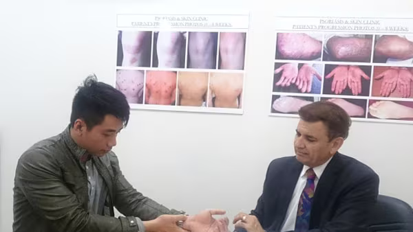 Mối liên hệ giữa bệnh vẩy nến với nhiễm trùng, nhiễm khuẩn và nấm