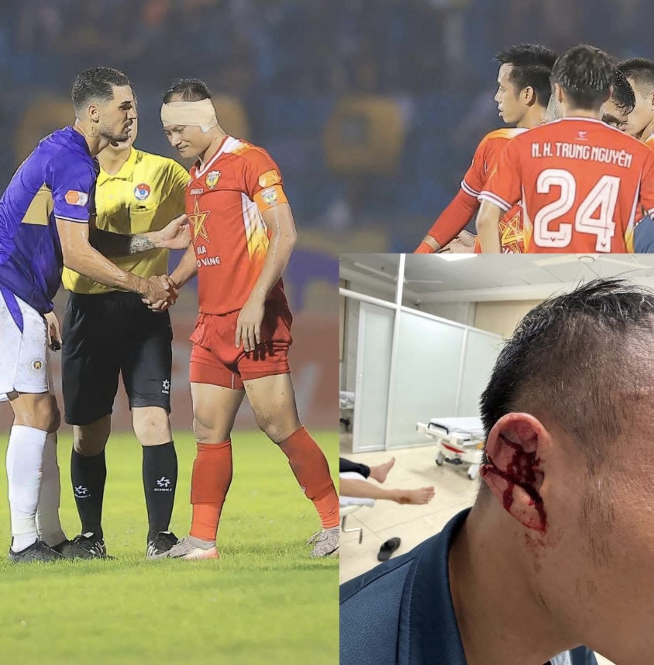 Khán giả V-League cảm phục “chiến binh” Trọng Hoàng