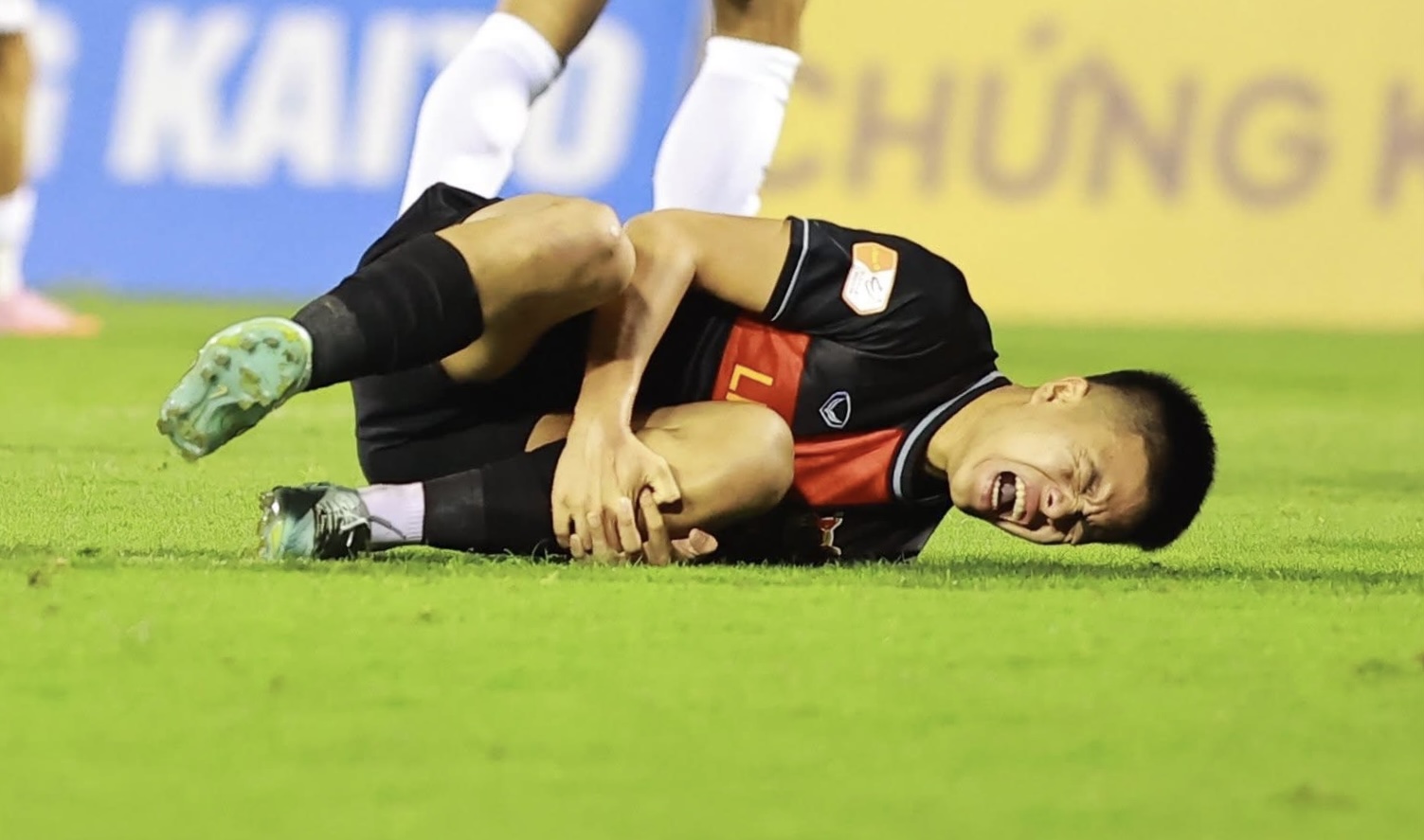 Thành Trung may mắn chỉ chấn thương nhẹ