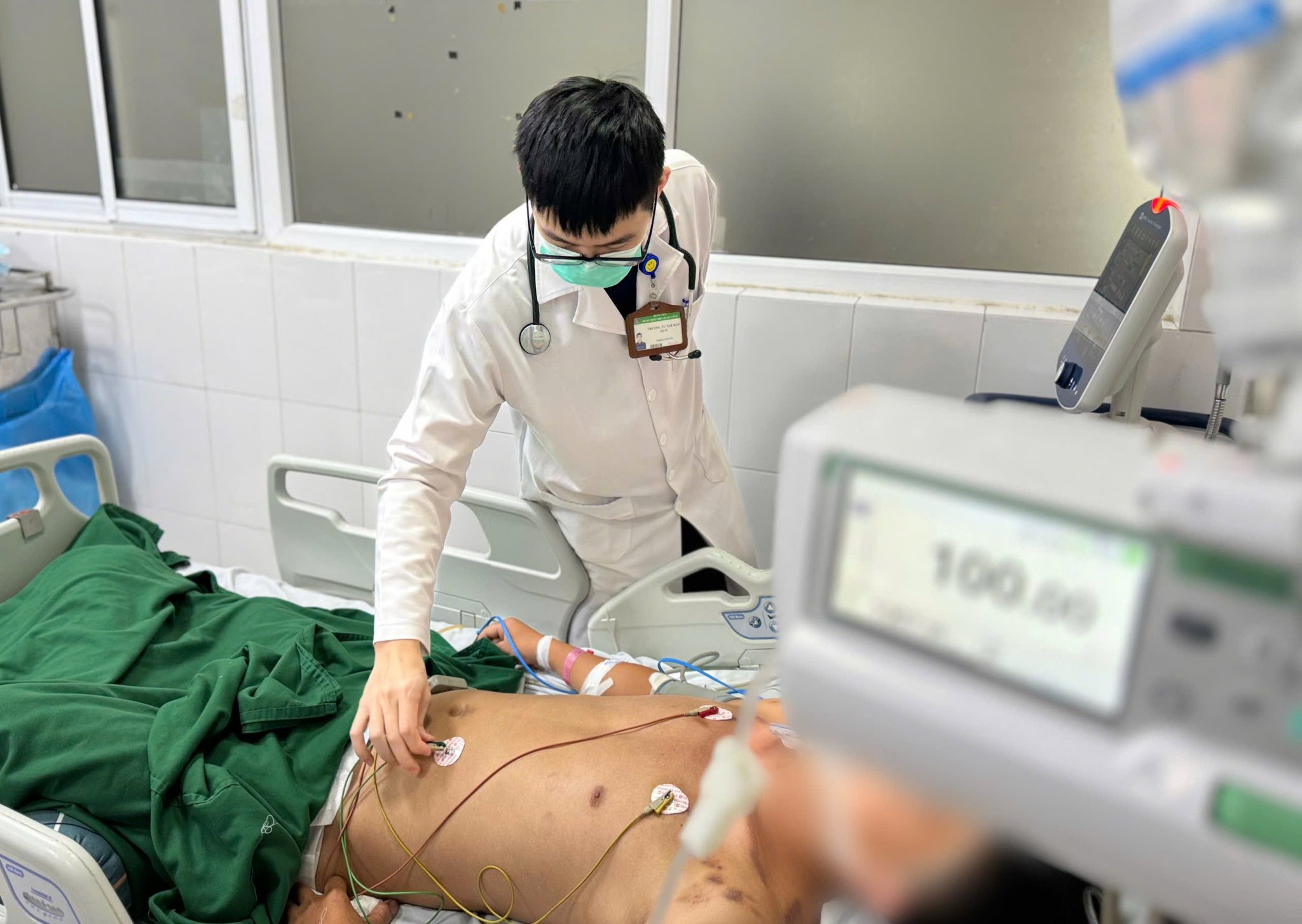 Nam thanh niên tử vong vì phát bệnh dại sau nửa năm bị chó cắn