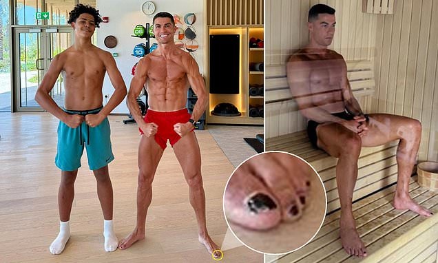 Sự thật ít ai ngờ đằng sau việc Ronaldo sơn đen móng chân