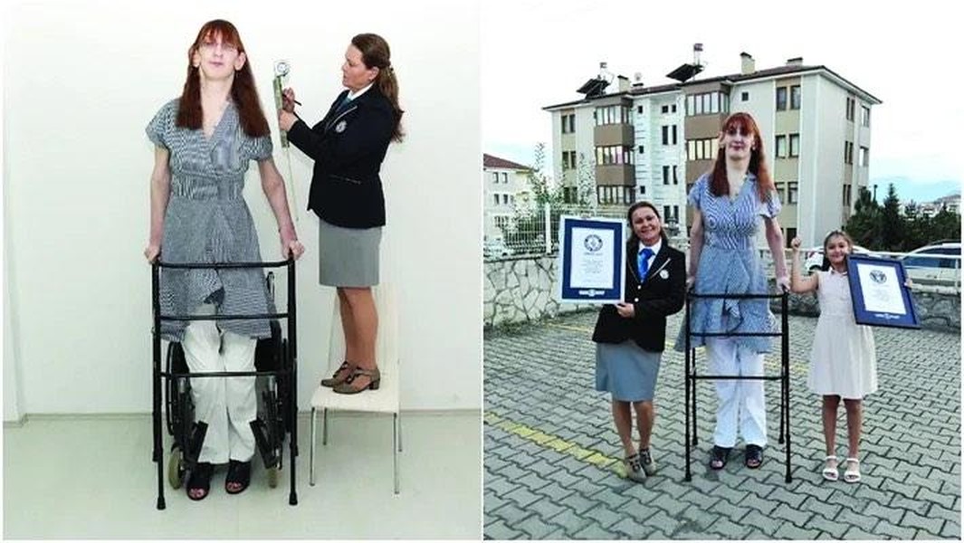 Những phụ nữ giữ kỷ lục Guinness thế giới về tự nhiên cơ thể