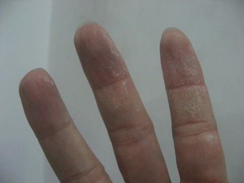 Thu gần 1.000 sản phẩm mỹ phẩm “càng gãi, càng ngứa” ảnh 3