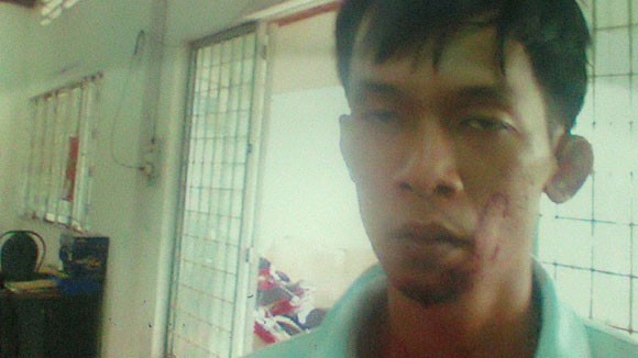 Khởi tố, bắt giam CSCĐ tấn công CSGT giữa phố ảnh 1