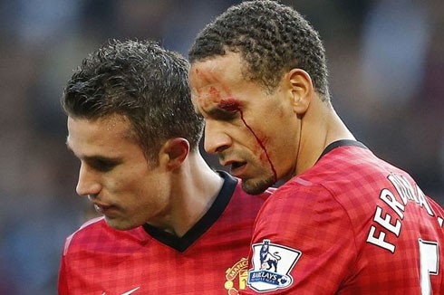 Nhà A. Cole mừng ra mặt khi Ferdinand suýt mù mắt ảnh 1