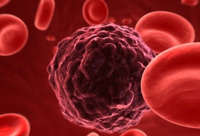 7 quy tắc sống giúp giảm nguy cơ huyết khối ảnh 1