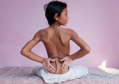 Cậu bé 12 tuổi có đuôi, được coi như thánh sống ảnh 1