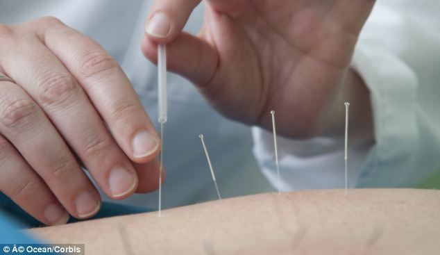 Phát hiện hàng trăm chiếc kim vàng trong chân người phụ nữ ảnh 2
