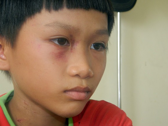 Người bố tàn ác đánh ép con viết “nhật ký” thù mẹ ảnh 1