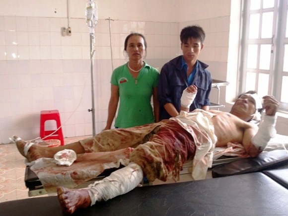 Tranh chấp đất rừng 6 người bị chém trọng thương ảnh 1