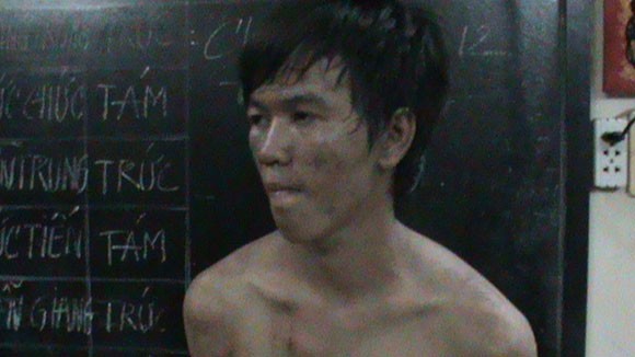 Ghen tuông, nam sinh đâm dao ngập hông bạn gái ảnh 1