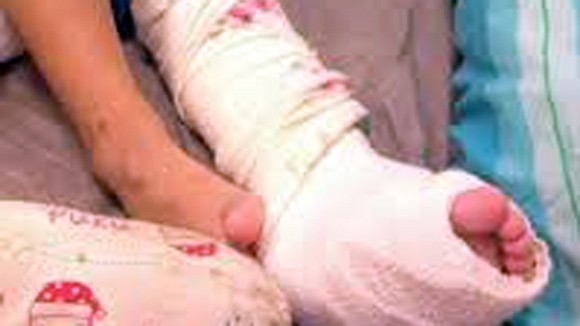 Giáo viên mầm non đẩy bé trai ngã gãy chân ảnh 1