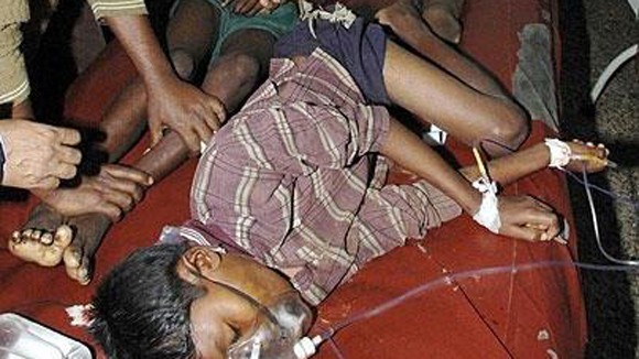 Ấn Độ: 22 học sinh tử vong vì bữa ăn miễn phí ảnh 1