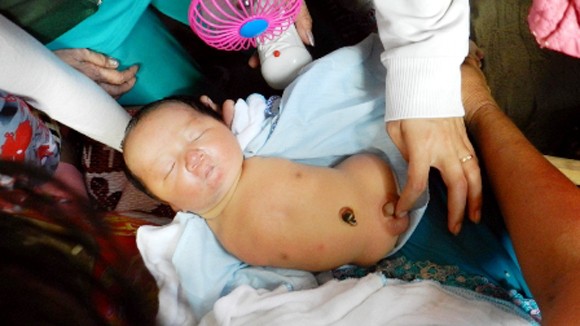 Cậu bé dị tật không chân tay kỳ lạ được phong làm "cậu hai" thần thánh ở An Giang ảnh 1