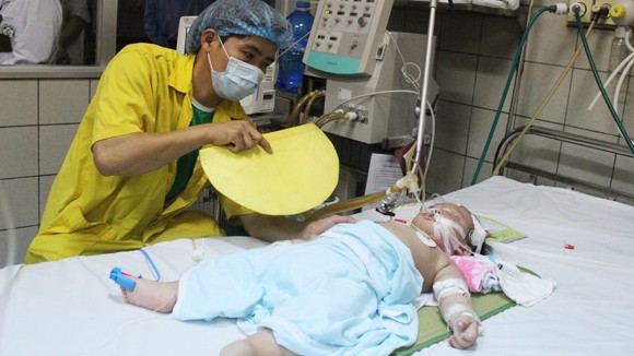 Nắng nóng, nhiều trẻ nhiễm bệnh vì nằm điều hòa ảnh 1