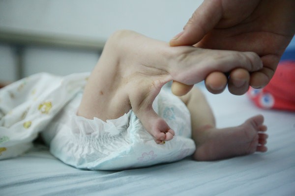 Đáng thương bé gái sơ sinh bị cha mẹ bỏ rơi vì có… 3 chân ảnh 1