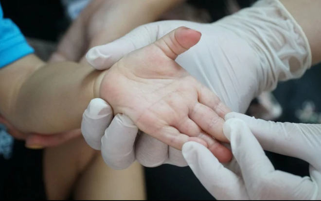 Số mắc tay chân miệng vẫn đang gia tăng (Ảnh minh họa)