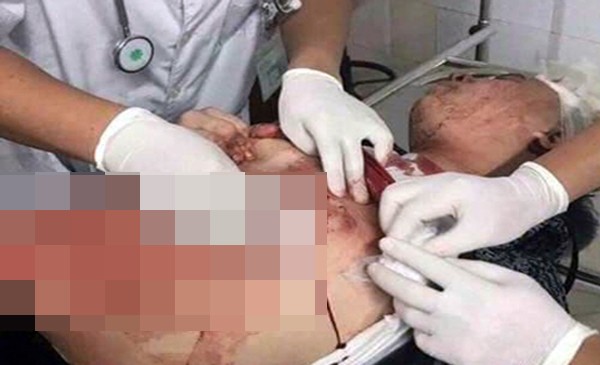 Giang hồ bắn nhau ngoài phố, truy sát vào tận bệnh viện ảnh 2 Giang hồ bắn nhau ngoài phố, truy sát vào tận bệnh viện ảnh 2