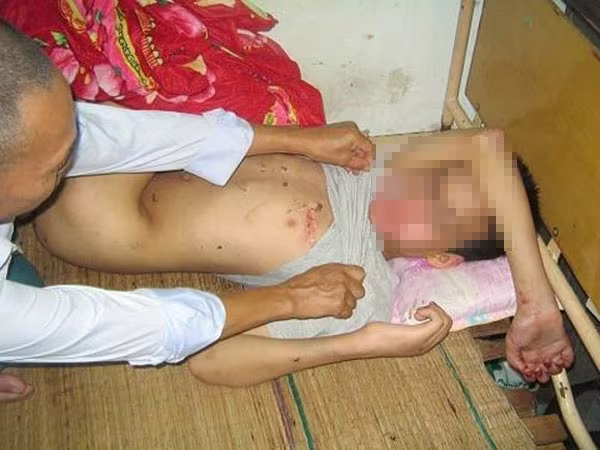 Trẻ em nam - nạn nhân mới của tội phạm xâm hại tình dục: Nạn nhân không chỉ là bé gái ảnh 2 Trẻ em nam - nạn nhân mới của tội phạm xâm hại tình dục: Nạn nhân không chỉ là bé gái ảnh 2