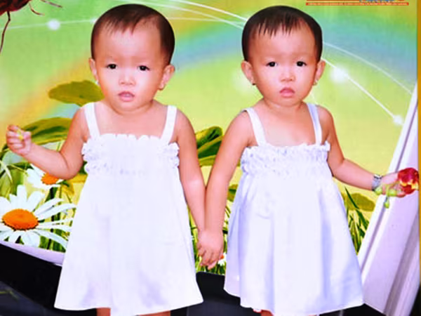 Bí ẩn khó lý giải ở vùng đất có 50 cặp vợ chồng sinh đôi ảnh 2 Bí ẩn khó lý giải ở vùng đất có 50 cặp vợ chồng sinh đôi ảnh 2
