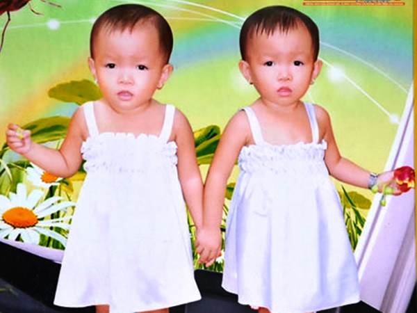 Bí ẩn khó lý giải ở vùng đất có 50 cặp vợ chồng sinh đôi ảnh 2 Bí ẩn khó lý giải ở vùng đất có 50 cặp vợ chồng sinh đôi ảnh 2