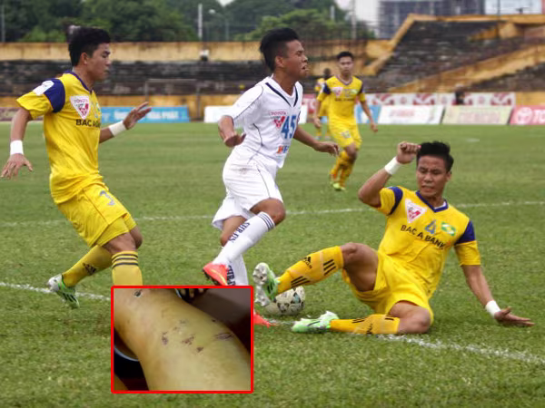 Sự thô bạo đang giết chết bóng đá ảnh 1