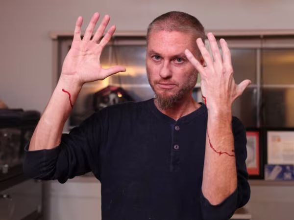 Cho rắn độc cắn để tìm ra thuốc chữa ảnh 1 Cho rắn độc cắn để tìm ra thuốc chữa ảnh 1