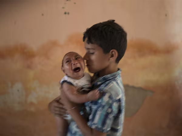 Kinh hãi virus gây tật đầu nhỏ ở trẻ sơ sinh ảnh 1