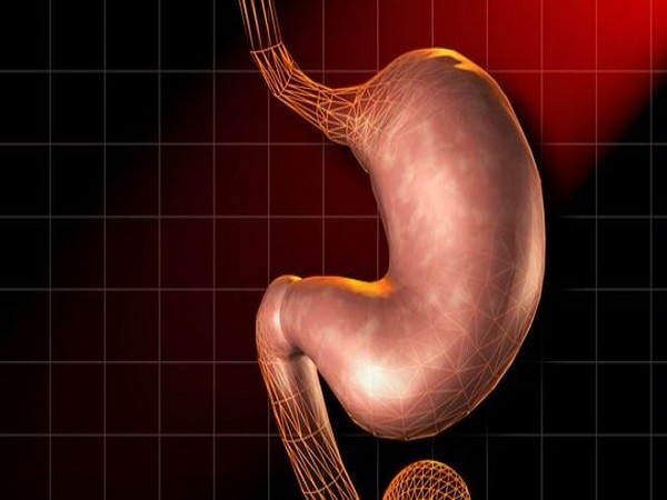 Xét nghiệm hơi thở có thể phát hiện nguy cơ ung thư dạ dày ảnh 1 Xét nghiệm hơi thở có thể phát hiện nguy cơ ung thư dạ dày ảnh 1