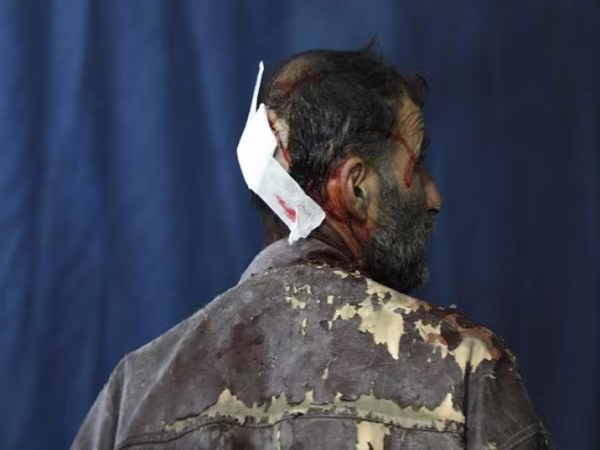 Xung đột Syria: Hình ảnh đau thương người dân phải gánh chịu do chiến tranh ảnh 7 Xung đột Syria: Hình ảnh đau thương người dân phải gánh chịu do chiến tranh ảnh 7