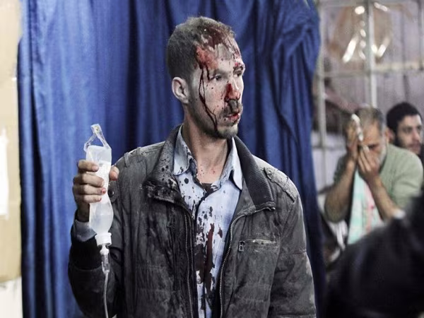 Xung đột Syria: Hình ảnh đau thương người dân phải gánh chịu do chiến tranh ảnh 8 Xung đột Syria: Hình ảnh đau thương người dân phải gánh chịu do chiến tranh ảnh 8