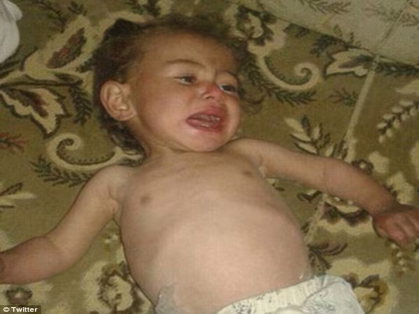 Nội chiến Syria: Trẻ em đang chết dần chết mòn vì đói ăn ảnh 1