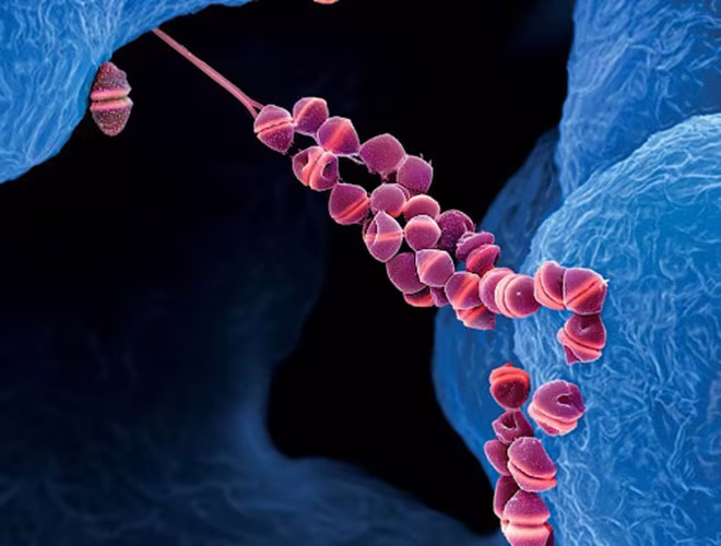 Tác nhân gây bệnh là liên cầu streptococcus, có thể tồn tại cả trong lợn khỏe và lợn bệnh Tác nhân gây bệnh là liên cầu streptococcus, có thể tồn tại cả trong lợn khỏe và lợn bệnh