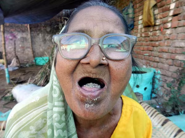 Gặp cụ già nghiện ăn 3-4 bát cát, sỏi mỗi ngày ảnh 5