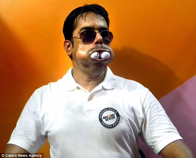 Người đàn ông có khoang miệng khổng lồ ảnh 3 Người đàn ông có khoang miệng khổng lồ ảnh 3