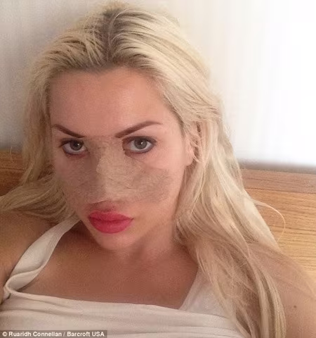 Cô gái cắt phăng 6 xương sườn để có vòng eo con kiến 35cm ảnh 4