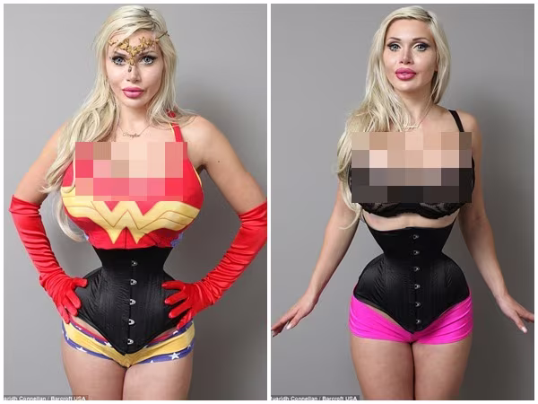 Cô gái cắt phăng 6 xương sườn để có vòng eo con kiến 35cm ảnh 1