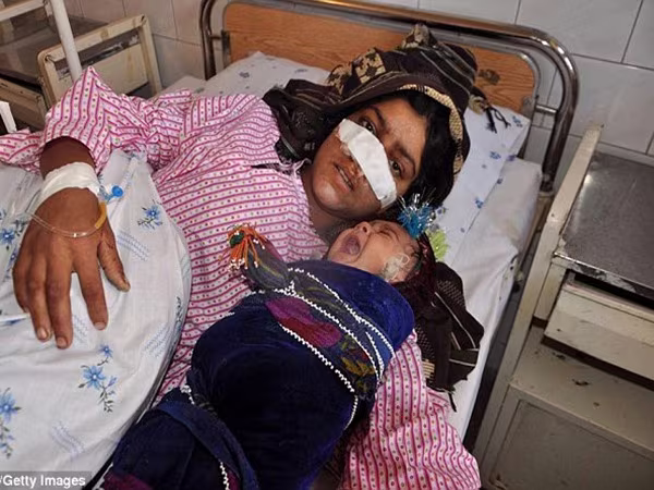 Afghanistan: Chồng cắt phăng mũi vợ rồi bỏ chạy theo Taliban ảnh 2 Afghanistan: Chồng cắt phăng mũi vợ rồi bỏ chạy theo Taliban ảnh 2