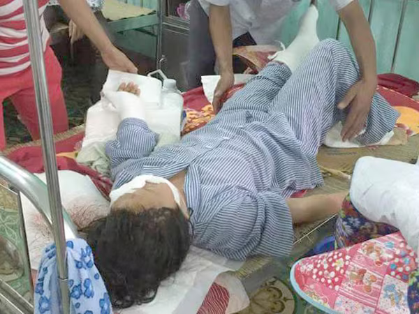 Chồng cắt đứt gân tay vợ, nhưng vợ không yêu cầu xử lý, có khởi tố được không? ảnh 1 Chồng cắt đứt gân tay vợ, nhưng vợ không yêu cầu xử lý, có khởi tố được không? ảnh 1