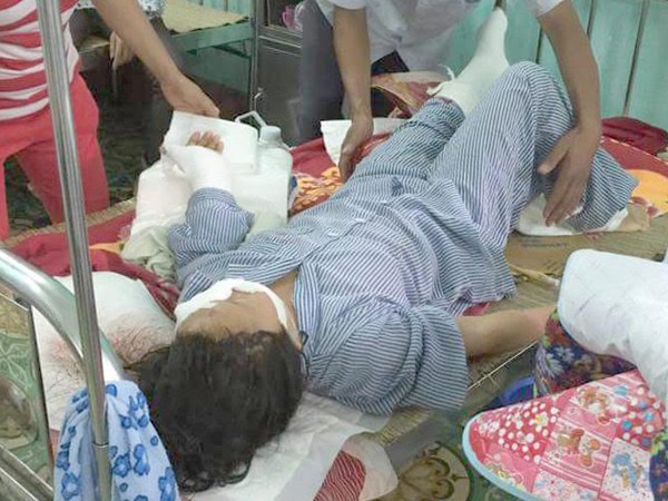 Chồng cắt đứt gân tay vợ, nhưng vợ không yêu cầu xử lý, có khởi tố được không? ảnh 1 Chồng cắt đứt gân tay vợ, nhưng vợ không yêu cầu xử lý, có khởi tố được không? ảnh 1