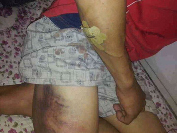 Phối hợp bảo hộ lao động Việt Nam bị hành hung tại Algeria ảnh 1 Phối hợp bảo hộ lao động Việt Nam bị hành hung tại Algeria ảnh 1