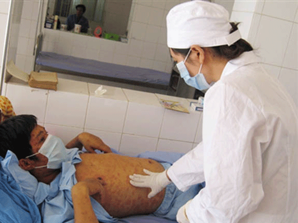 Dừng viện trợ thuốc cho bệnh nhân HIV: Nguy cơ đại dịch bùng phát trở lại? ảnh 1 Dừng viện trợ thuốc cho bệnh nhân HIV: Nguy cơ đại dịch bùng phát trở lại? ảnh 1