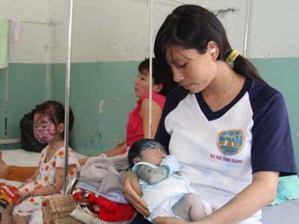 Cảnh giác bệnh truyền nhiễm trong mùa Đông Xuân ảnh 1 Cảnh giác bệnh truyền nhiễm trong mùa Đông Xuân ảnh 1