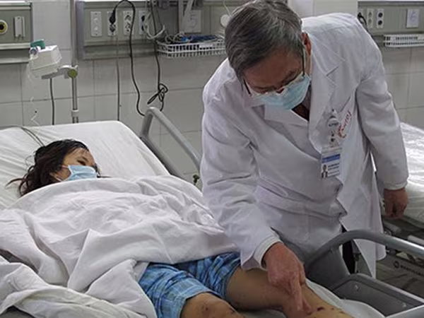 Lo ngại bùng phát bệnh viêm màng não mô cầu ảnh 1