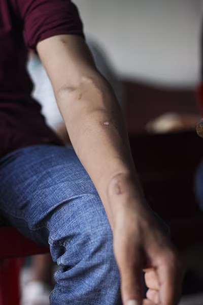 Người chị cả gánh vác trên vai cả một gia đình bệnh tật ảnh 3 Người chị cả gánh vác trên vai cả một gia đình bệnh tật ảnh 3