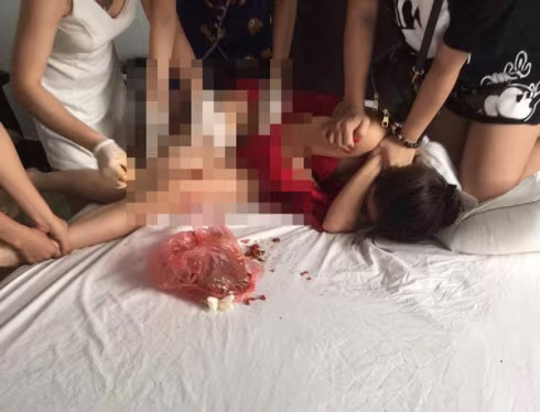 Vụ đánh ghen dã man ở Bình Xuyên: Nạn nhân cần làm đơn tố cáo để tìm lại công bằng ảnh 3 Vụ đánh ghen dã man ở Bình Xuyên: Nạn nhân cần làm đơn tố cáo để tìm lại công bằng ảnh 3